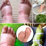 ALIVIO NATURAL PARA PIERNAS HINCHADAS E INFLAMACIÓN ARTICULAR